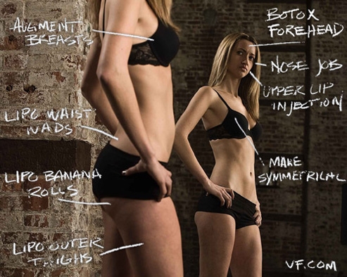 liposuzione, cellulite, gambe, chirurgia estica, grasso,
