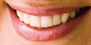 Tecnico dentale ODONTOTECNICO